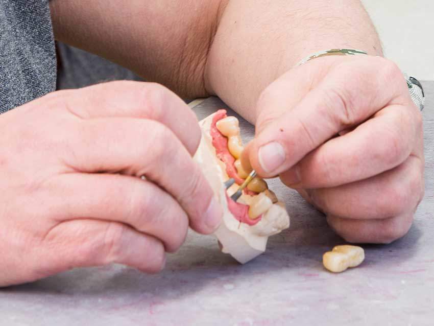 Der Zahtechnikermeister bearbeitet im Labor eine von ihm hergestellte Zahnprothese (Detail der Hände).